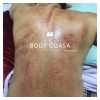 body-guasa