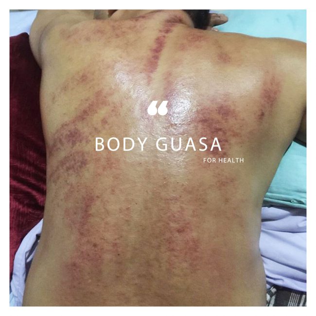 body-guasa